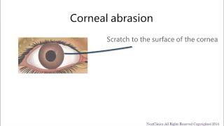 Corneal abrasion