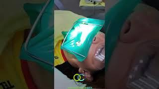 Tratamiento de Conducto/Endodoncia