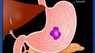 The digestion process  What happens to your food as it travels through your body until it exits