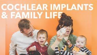 Cochlear Implants & Family Life
