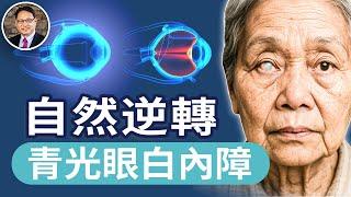白內障、青光眼不用手術？自然逆轉？兩位患者的親身見證與科學整合方法｜四維健康