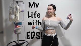  DAY IN MY LIFE: with EDS, Tubes & Catheters! | Amy Lee Fisher 