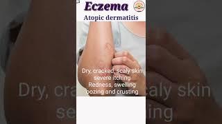 allergic skin diseases | skin diseases name symptoms #shorts