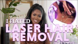 PROS & CONS of LASER HAIR REMOVAL for DARK SKIN | Esthetician’s POV