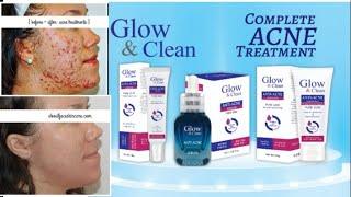 Glow & Clean 3 in 1 Anti Acne Pack | Glow and Clean Acne Cleanser | Glow and Clean Acne cream |Acne