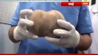 Dr Devendra Patil - Bladder Stone Record Breaking Surgery