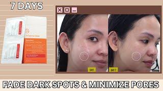 Dr. Dennis Gross Peel Pads Review: Does It Really Work?