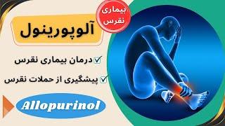 درمان بیماری نقرس و جلوگیری از حملات حاد نقرس با داروی آلوپورینول (Allopurinol)