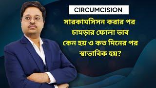 সারকামসিসন করার পর চামড়ার ফোলা ভাব কেন হয় ও কত দিনের পর স্বাভাবিক হয়