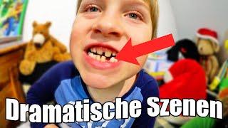 Der Zahn muss raus    Not-OP im Kinderzimmer | TipTapTube UNCUT