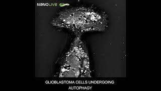 Label free live cell imaging glioblastoma cells undergoing autophagy #science #biotechnology