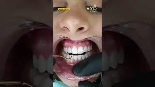 The best dental clinic in Turkey | Art Of Smile