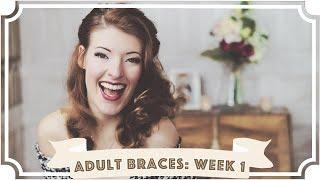 Adult Braces: What It's Really Like (Week 1) [CC]