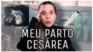 NÃO TENHA MEDO DO PARTO CESÁREA - MEU RELATO DE PARTO.