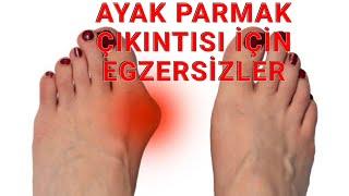 AYAK PARMAK ÇIKINTISI VE EGZERSİZLERİ (HALLUKS VALGUS)