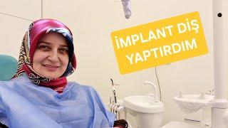 İMPLANT  DİŞ YAPTIRDIM / İMPLANT  DİŞ / İMPLANT ACIRMI ?