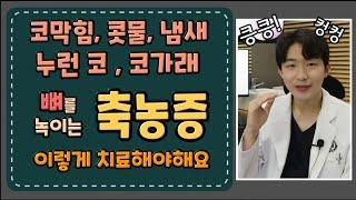 축농증수술 꼭 해야할까?ㅣ코막힘, 코냄새, 코이물감, 누런코, 코가래, ㅣ축농증, 부비동염 환자분들이 자주 묻는 질문 TOP 6