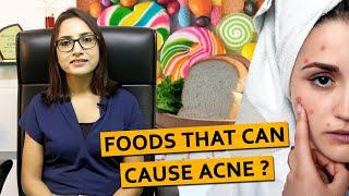 Foods that can cause acne?  | Dr. Deepika Lunawat