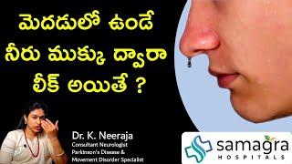 Understanding Brain Fluid Leak (CSF Rhinorrhea): Causes, Symptoms & Treatment | Dr. Neeraja |