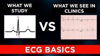 Basics of ECG - 1 | All about ECG leads | Aslack saleem