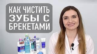 Как и чем чистить зубы с брекетами | стоматология и брекеты в Самаре