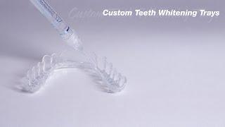 Custom Teeth Whitening Trays