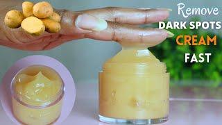 Best homemade cream for dark spots | Dark Spots Removal Cream