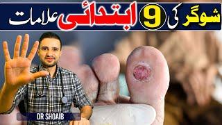 "شوگر کی بیماری کے ابتدائی علامات - Sugar ki Initial Symptoms in Urdu/Hindi"