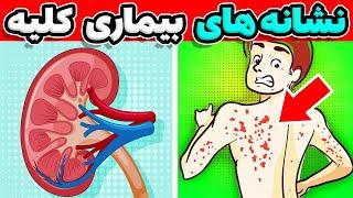 کاش این علائم  رو زودتر میدونستم | علائم و نشانه های اولیه بیماری کلیه