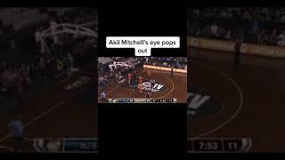 worst injuries in basketball  #basketball #kurlyheadmarr #shorts