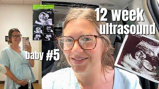 REUPLOADED: HCG levels update & my 12 weeks appointment