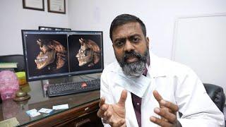 Bimaxillary Osteotomy Surgery - Double Jaw Surgery Case Study