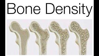 #BoneDensity #Osteoporosis #Hyperparathyroidism #Baboujian #Acupuncture #Accupuncture