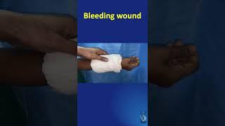 Shorts #41: How to handle a bleeding hand wound in Casualty -Method of applying Compression dressing