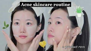 Non-drying Acne Skincare Routine & product recs! (tea tree, heartleaf, aloe)