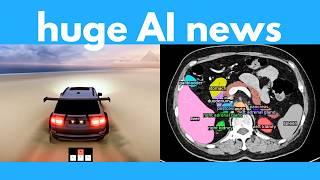 AI makes any video game, Full video control, AI finds cancer, FLUX tools, Open-source model beats o1