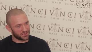 Chris Snowden - Micro Scalp Pigmentation - Vinci Hair Clinic Manchester