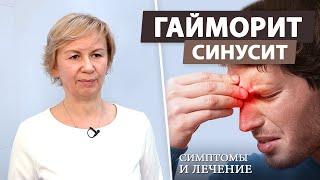 Как эффективно лечить гайморит? (синусит)