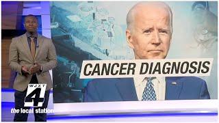 Biden has been diagnosed with aggressive prostate cancer