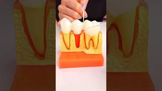 How To Floss Under A Bridge