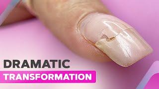 How to Fix Broken Nails Like a Pro | Nail Extensions with Dual Forms