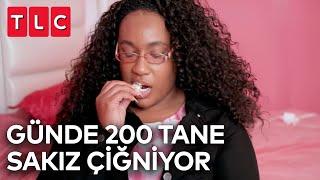 Günde 200 Sakız Çiğniyor | Benim Tuhaf Alışkanlığım: Şimdi Nasıllar?