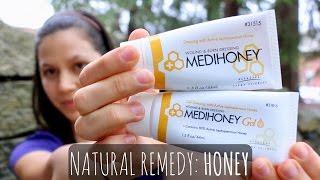 Honey Heals Wounds, Burns & Even MRSA? | My Review of MEDIHONEY