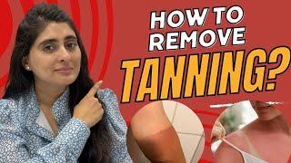 How to remove tanning | How to remove tan from face | Tan removal | Tan removal home remedies |