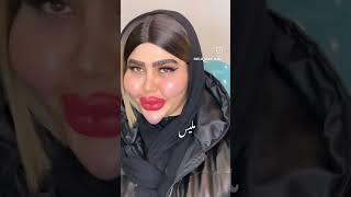 واقعا شکل باربی شدباربی ایرانی🫣ژل صورت و لبIranian BarbieFace fillerLip filler