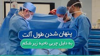 پنهان شدن طول آلت به دلیل چربی ناحیه زیر شکم