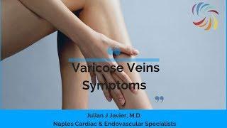 Common Symptoms of Varicose Veins by Naples Cardiac & Endovascular Specialists