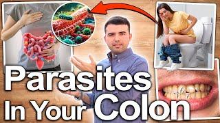 YOU ARE FULL OF PARASITES - Symptoms That Indicate That You Need A Parasite Cleanse