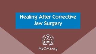 Healing After Corrective Jaw Surgery