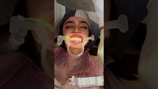 صفر تا صد باندینگ ارتودنسی | Orthodontic bonding, zero to hundred